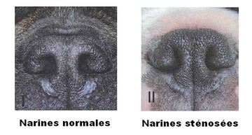 Narines normales et sténosées